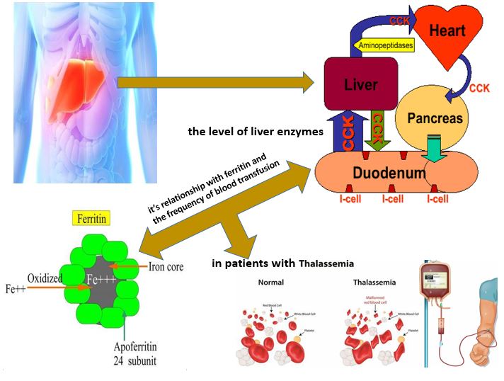Evaluation of the level of liver enzymes and its relationship with ferritin and the frequency of blood transfusion in patients with thalassemia 